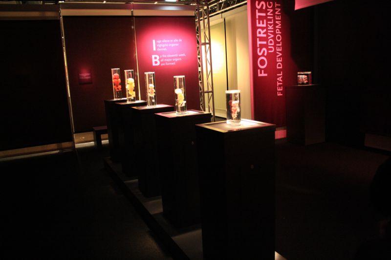 gal/evenements/Bodies_-_The_Exhibition/Bodies_Premier_Exhibition18.jpg
